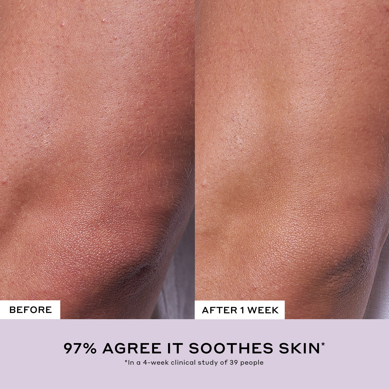 Strength Aprés-Skin Rich Rescue Treatment