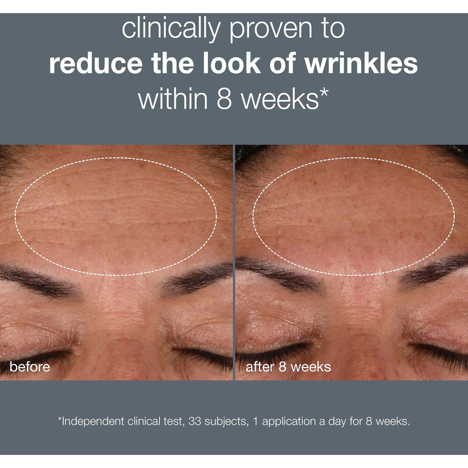 Dynamic Skin Recovery