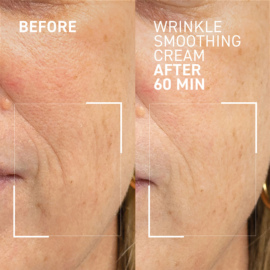 Wrinkle Smoothing Cream