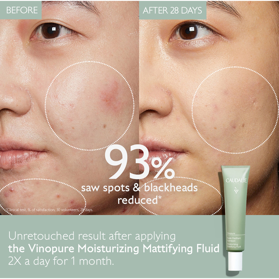 Moisturizing Mattifying